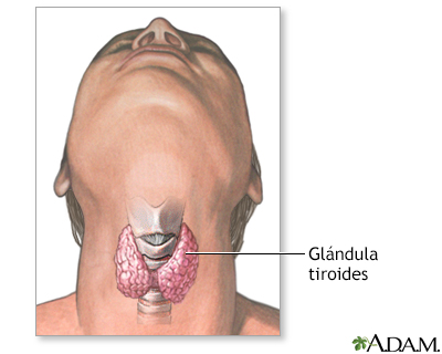 El cuello caliente duele la cabeza