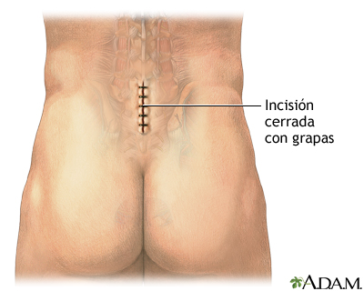Que el ejercicio de sheynogo de la osteocondrosis