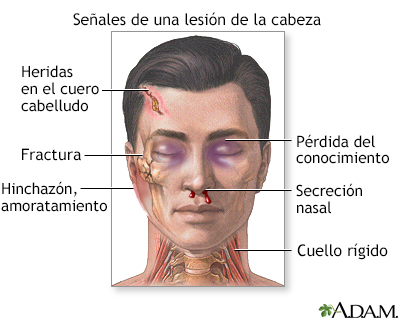 De los riñones duele la cabeza
